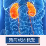 腎病成因概覽 腎病成因概覽